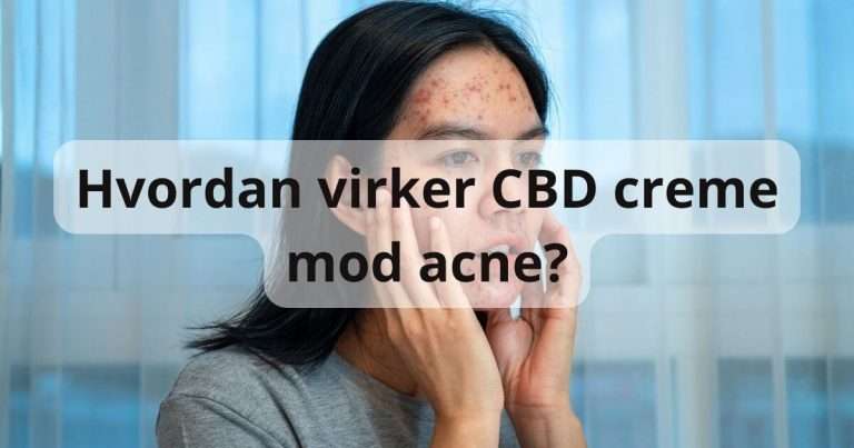 Hvordan virker CBD creme mod acne?