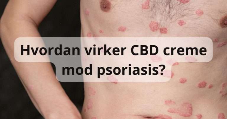 Hvordan virker CBD creme mod psoriasis?